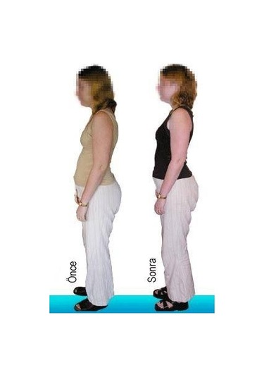 Medikaltec Backtone Dik Duruş Korsesi Elektronik Sensörlü Medium