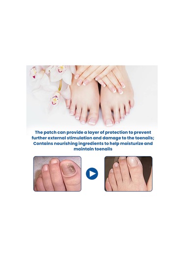 Padalink 32 Adet Tırnak Mantar Tamir Yamağı - Glyserin, Allantoin Ve Çay Ağacı Yağı İçeren, 2.8x2.3cm Boyutunda Parçalar