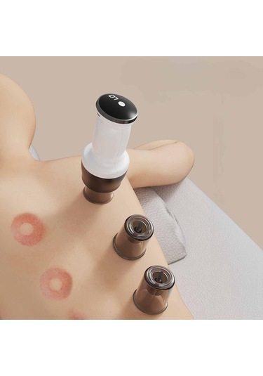 Suntek Elektrikli Kupa Masajı Vakum Makinesi Tüm Vücut Omuzlar Beyaz