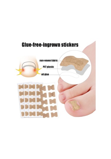 10 Adet Tutkalsız Ortopedik Tırnak Ayak Düzeltici Beyaz Alt