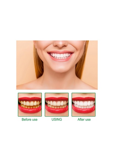 Mufunye Eelhoe 1 Adet Diş Beyazlatma Kalemi Parlatıcı Alet Seyahat/gezi/ev Günlük Kullanım İçin Taşınabilir