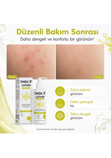 Thol's Scabthol Kükürtlü Vücut Losyonu 200 ML