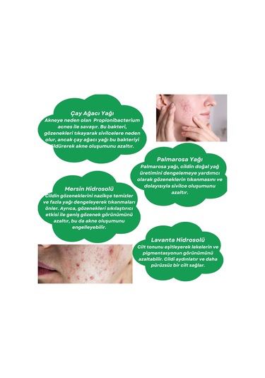 Antı-acne Toner Çay Ağacı Ve Palmarosa Özlü Cilt Bakım Suyu