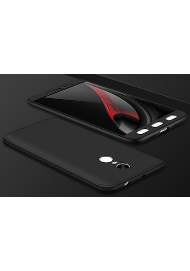 Xiaomi Mi 5S Kılıf Zore Kamera Çıkıntılı 360 Tam Koruma Ays