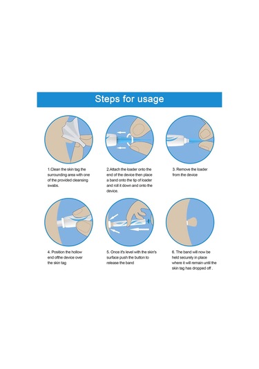 Siğil Sökücü Cilt Etiketi Temizleme Kalemi, Benleri Kaldırmak İçin Onarım Etiketli Set - Mavi Beyaz