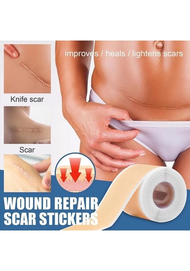 10-50 Cm Silikon Yara Izleri Yama Yara Bandı Sivilce Yanık Yara Izi Tedavisi Kapak Kulak Düzelticiler Verimli Onarım Hasarlı Cilt Levha