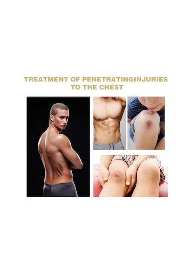 Vkemall Su Geçirmez Ve Nefes Alabilen Yara Bandı - Hızlı İyileşme İçin Vücut Yapıştırıcı