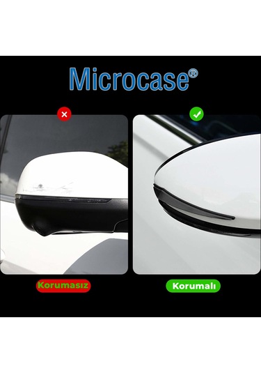Microcase Universal Esnek Ayna Ve Kapı Kenar Çizilme Önleyici Koruyucu Seti 4lü Al5360 Siyah