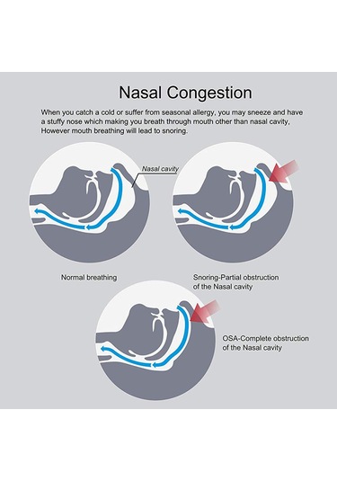 Vkemall Anti Horlama Burun Genişleticileri Horlamayı Azaltır Burun Tıkanıklığını Giderir Şeffaf