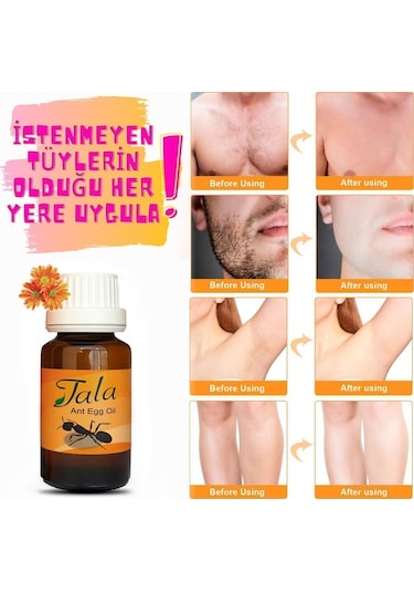 Karınca Yumurtası Yağı & Epilasyon Sonrası Nemlendirici Ve Aydınlatıcı Vücut Losyonu 100 ML