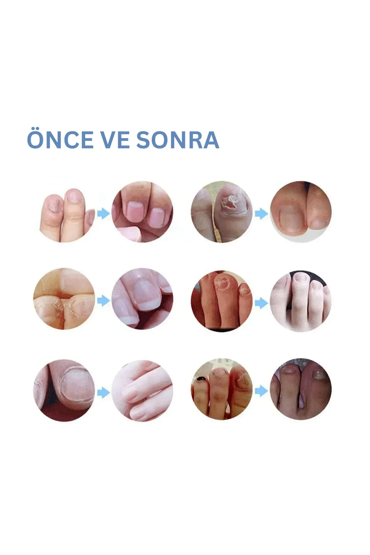 Tırnak Kalemi - El Ve Ayak Tırnağı Onarım