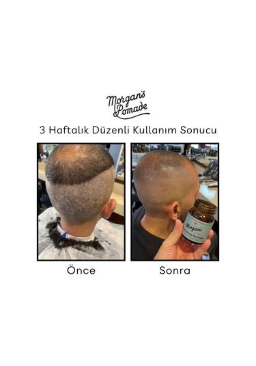Morgan's Pomade Cooling Scalp Treatment - Egzama Kepek Karşıtı Baş Derisi Bakım Tedavisi 100 G