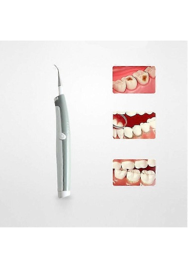 Ultrasonik Elektrikli Diş Temizleyici Diş Lekesi Temizleme Diş Bakımı