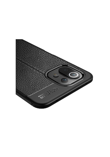 Xiaomi Mi 11 Lite Kılıf Zore Niss Deri Desenli Silikon Kılıf