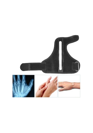 Arwex Baş Parmak Tespit Ateli Dequervain Ateli Sabitleyici Metal Destek