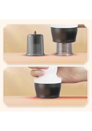 Suntek Elektrikli Kupa Masajı Vakum Makinesi Tüm Vücut Omuzlar Beyaz