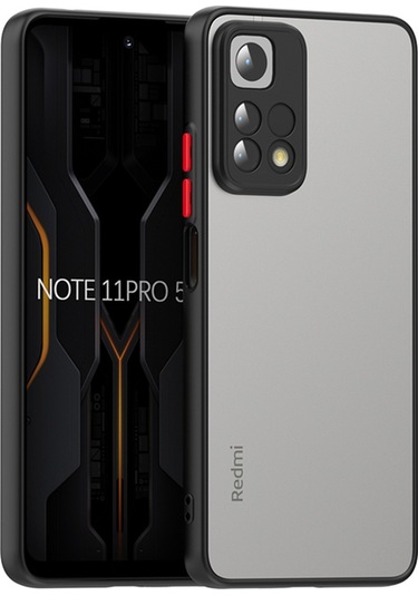 Zore Redmi Note 11 Pro 5g Kılıf Msra Hux Kapak - Lacivert Lacivert
