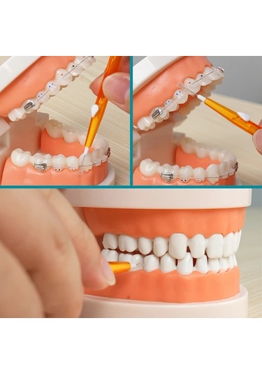 Willowhaven 0.7mm Mavi Diş Arası Fırçası 10lu Set - Taşınabilir, Ergonomik, Plak Temizleme