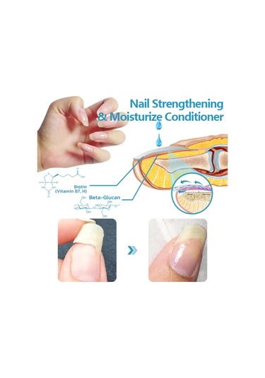 Eelhoe Eelhoe 15 Ml Tırnak Tırnak Eti Bakımı Özü Tırnak Onarıcı