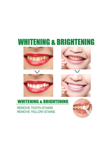 Mufunye Eelhoe 1 Adet Diş Beyazlatma Kalemi Parlatıcı Alet Seyahat/gezi/ev Günlük Kullanım İçin Taşınabilir