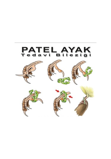 Palet Bacak  Bileziği 5 Adet