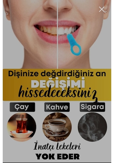 Upeka Diş Beyazlatma Kiti