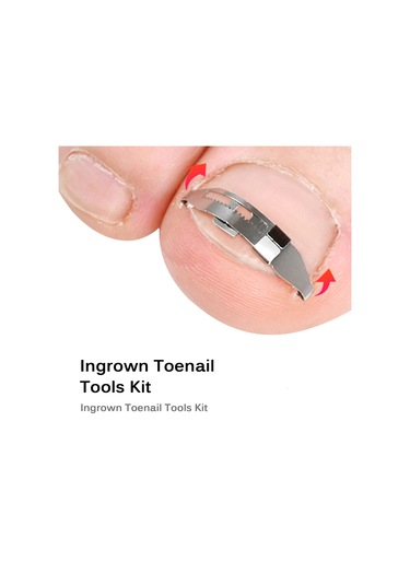 Moveevo 1 Adet Giyilebilir Batık Tırnak Düzeltici + Tıbbi Bant