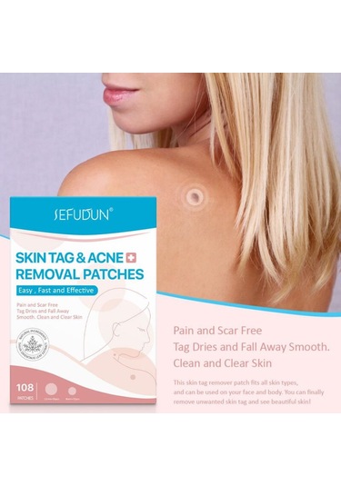 108 Adet Cilt Etiketi Akne Kaldırma Yamalar Ağrısız Pürüzsüz Temiz Temizle Cilt Hızlı Sökücü Sivilce Siğil Ana Yama Tedavisi Korur