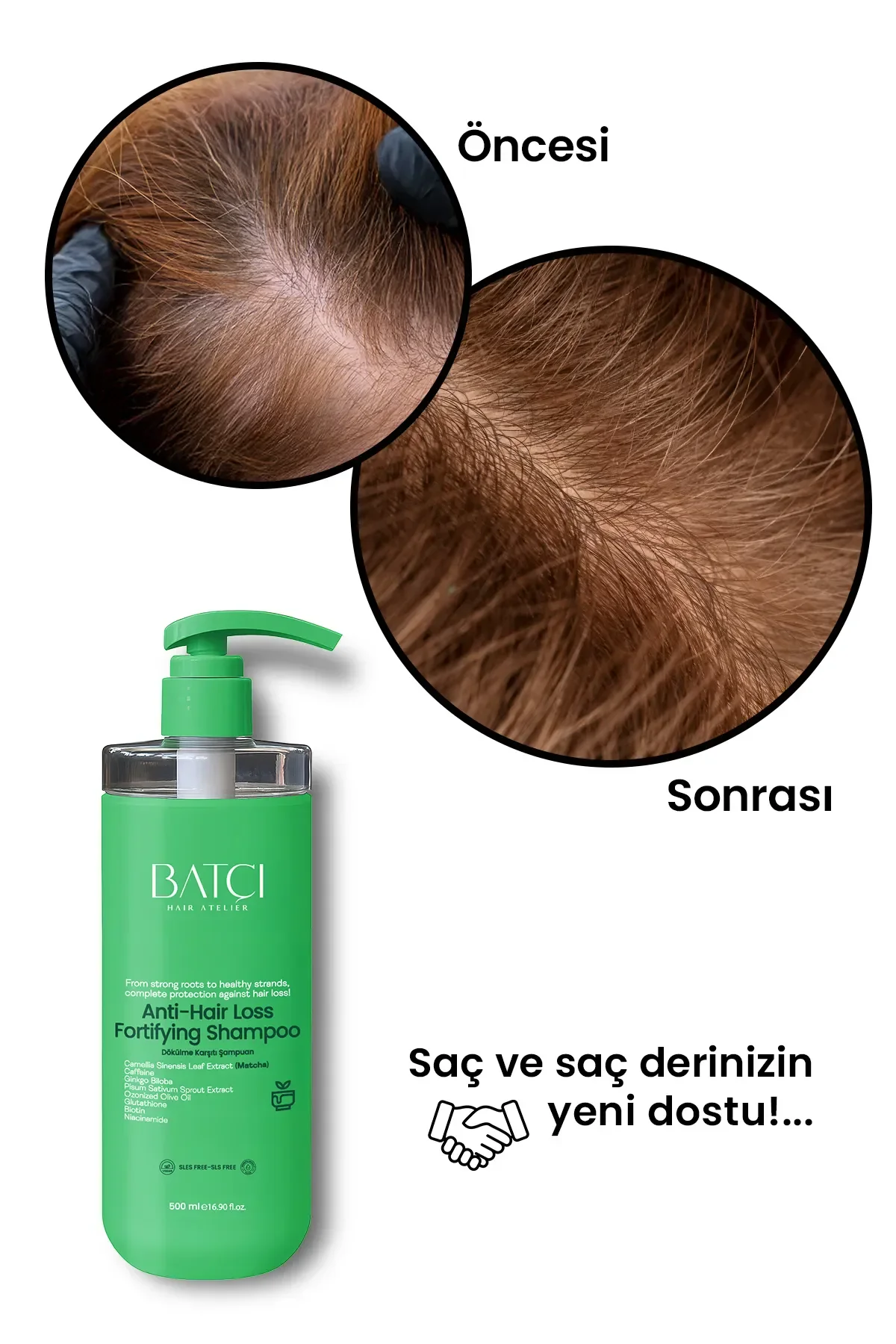 Maça Çaylı Saç Dökülmesine Karşı Hızlı Sac Uzatan Dolgunlaştırıcı Onarıcı Besleyici Şampuan 500 Ml Tüm Saçlar