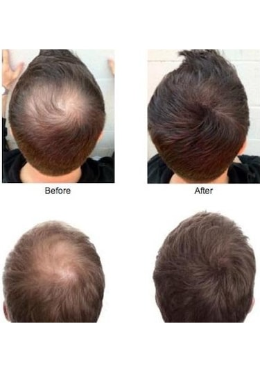 Sevich Koyu Kahve Saç Fiberi Keratin Saç Tozu 100 G