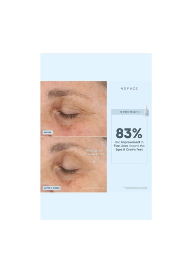 Nuface Süper Peptit Güçlendirici Yüz Serumu, 30 Ml Serumlar