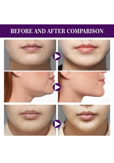 Youtek Eelhoe 60 Adet V Şekilli Su Geçirmez Yüz Germe Bandı - Cilt Dostu Esnek Yapışkan Bant