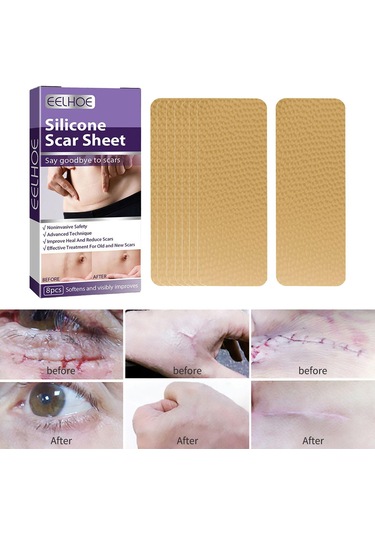 Dolıty Yanık İzleri Skar Yaması Çok Kullanımlı Yumuşak