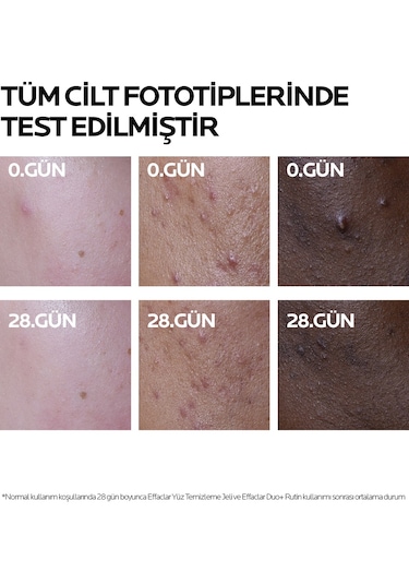 La Roche Posay Effaclar Duo+ M Akne Eğilimli Ciltler İçin Bakım Kremi 40 ML