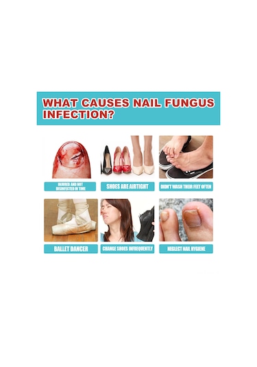 Vkemall South Moon Gece Tırnak Yaması - Mantar, Yumuşak Ve Hasarlı Tırnaklar İçin Onarıcı Bakım 16 Adet