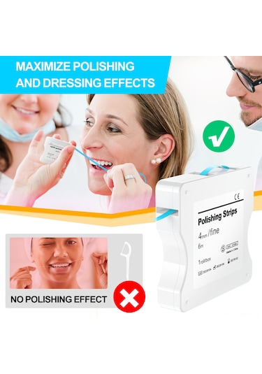 Suofeng Diş Parlatma Şeridi - 6 Metre Renkli Zımpara Kağıdı Mavi