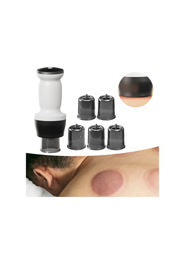 Suntek Elektrikli Kupa Masajı Vakum Makinesi Tüm Vücut Omuzlar Beyaz