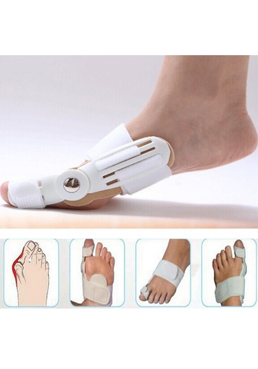 Büyük Kemik Ayak Bunyon Atel Ayak Düzleştirici Düzeltici De Juanete Ayak Ağrısı Giderici Halluks Valgus Düzeltme Ortopedik Malzemeleri