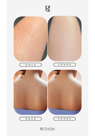 80 Factor Siyah Banyo Duş Kesesi Peeling Eldiveni %100 Floş Ipek Premium Unisex