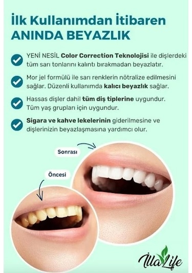 İlla Life Whitening Expert Hızlı Etkili Diş Beyazlatıcı Jel 50 ML