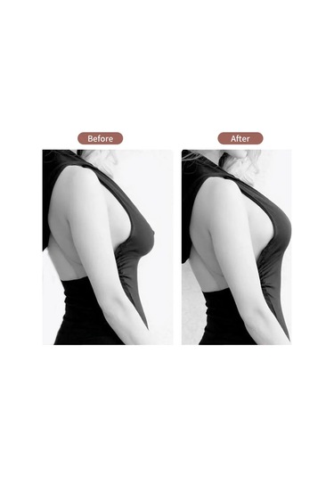 Göğüs Dikleştirme Bandı S Beden 2.5 Cm. 1 CM x 5 M