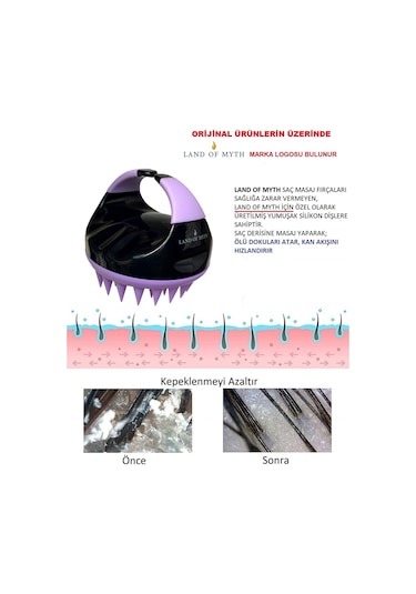 Land Of Myth Lom1402 Yeni Yumuşak Silikon Dişli Saç Derisi Masaj Fırçası Siyah