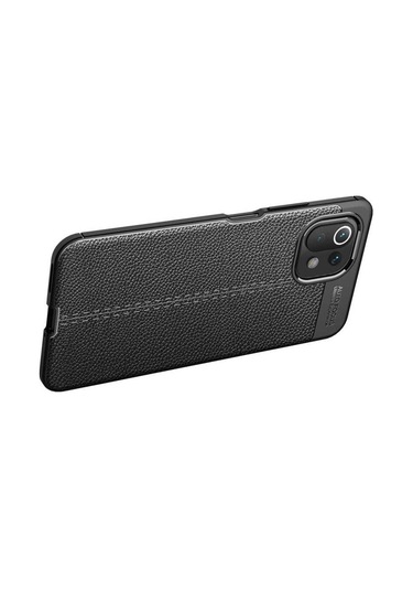 Xiaomi Mi 11 Lite Kılıf Zore Niss Deri Desenli Silikon Kılıf