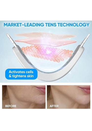 Youtek Elektrikli V-yüz Şekillendirici Masaj Aleti - Çene Ve Yüz Sıkılaştırma Cihazı