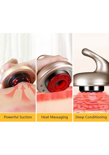 Geeksen Elektrikli Vakumlu Masaj Aleti - Sırt Ve Vücut Şişe Terapisi İçin Güçlü Emiş Altın