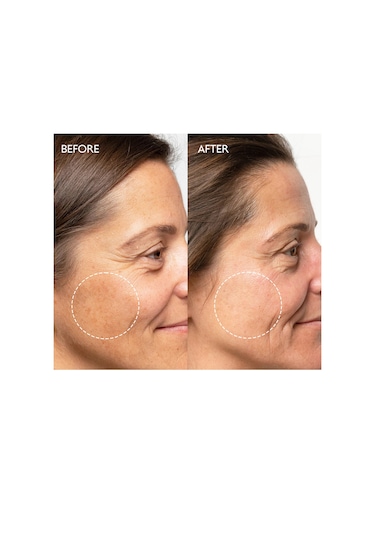 Gaia London Beyazlatıcı Etkili Leke Karşıtı Bakım Kremi 50 ML