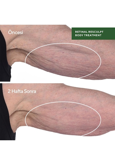 Retinal Resculpt Body Treatment - Retinal İçeren Yenileyici Vücut Bakımı 150ml
