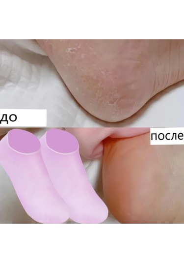 Skycity Esnek Silikon Nemlendirici Çorap Ve Ayak Kılıfı Yeşil, Mavi, Mor Her Ayak İçin Uygun Tek Boyut