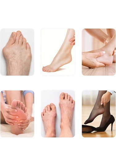 Akestoria Med Ayarlanabilir Cırtlı Baş Parmak Kemik Jel Düzeltici Fc-004 Standart