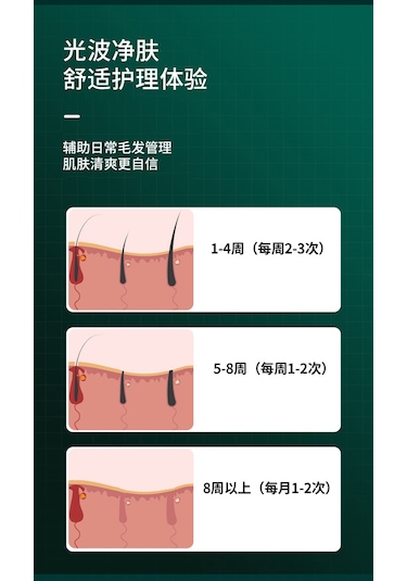 Elektrikli Tüy Alma Epilatör Lazer Cihazı Koyu Yeşil